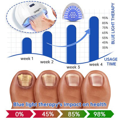QIAWI™ PureNail Schimmel Laserapparaat