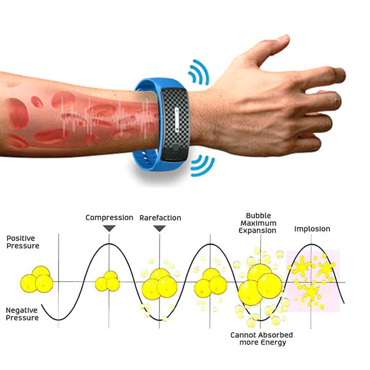 Histone⢠Matteo Ultrasonic Lichaamsvorm Polsband Proš„