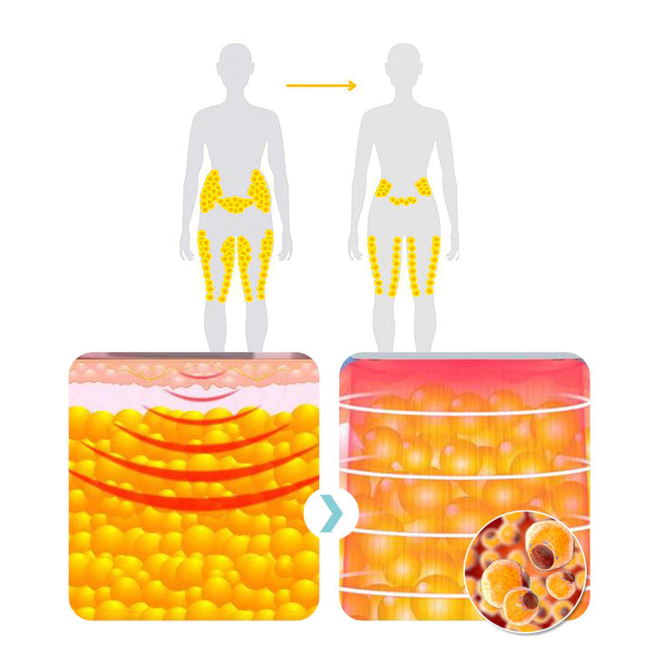 Histone⢠Matteo Ultrasonic Lichaamsvorm Polsband Proš„